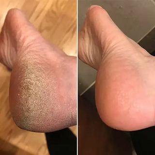 Talina Smooth Feet Rescue