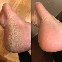 Talina Smooth Feet Rescue