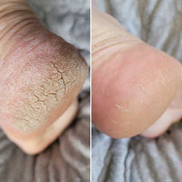 Talina Smooth Feet Rescue